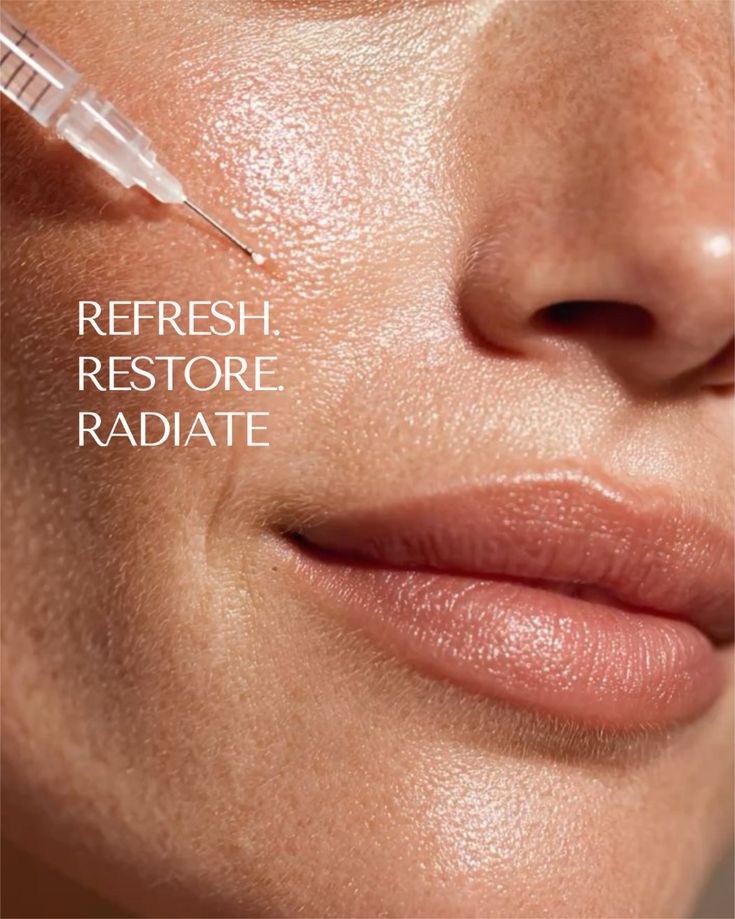 A refreshed, dewy complexion after subtle filler treatment